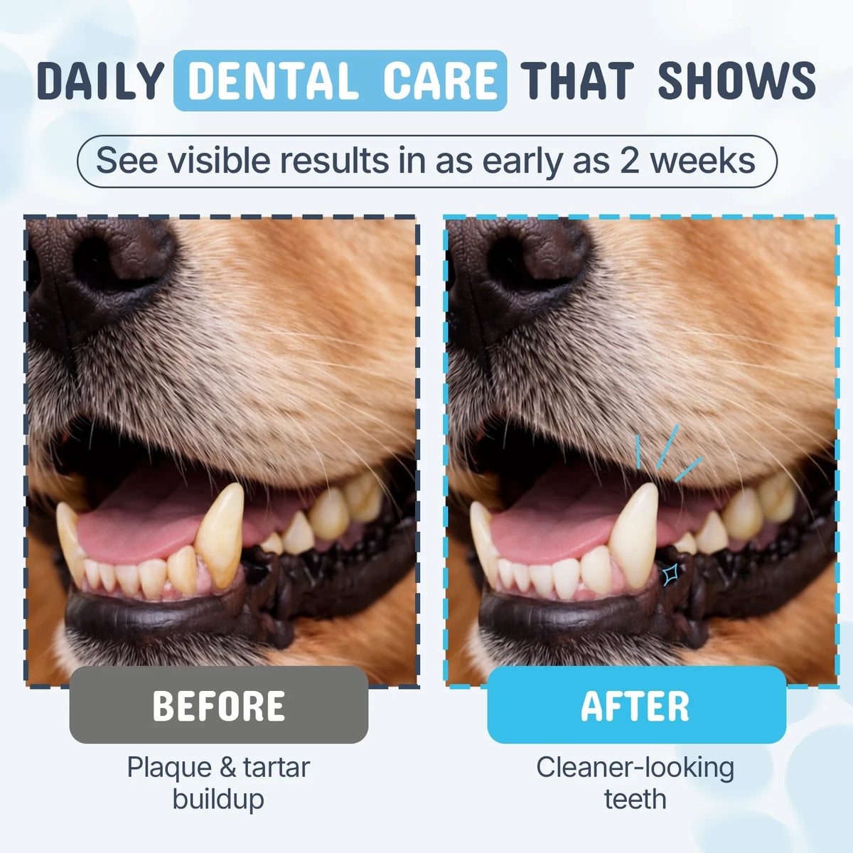 The Clean Teefs Bundle